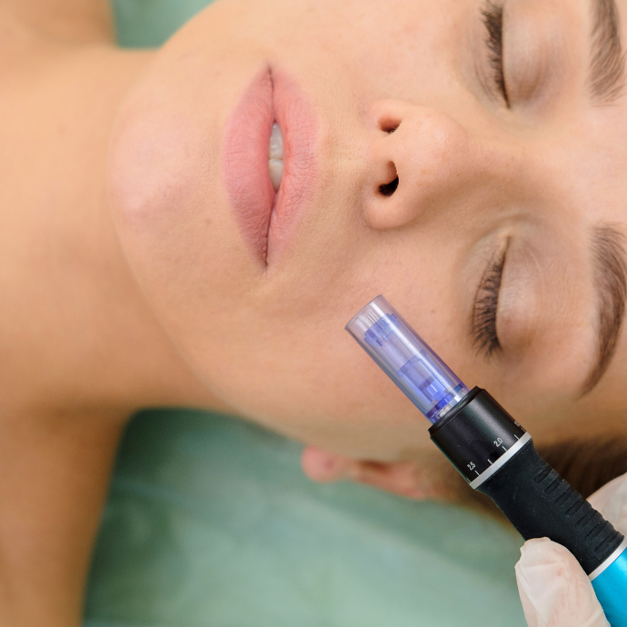 Dermapen o Microneedling Muestra un rostro femenino con ojos cerrados y a su lado una herramienta de tratamiento estético sujetado por un especialista
