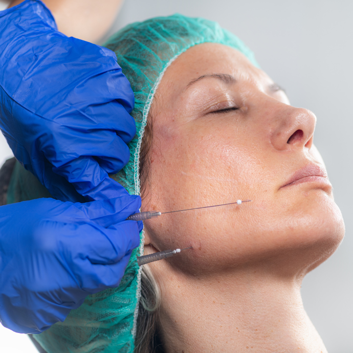 Hilos tensores Mujer con los ojos cerrados, gorro ver de hospital y tranquila,se practica un tratamiento tensor de la piel